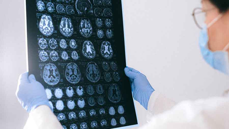 Doctor analizando una tomografía