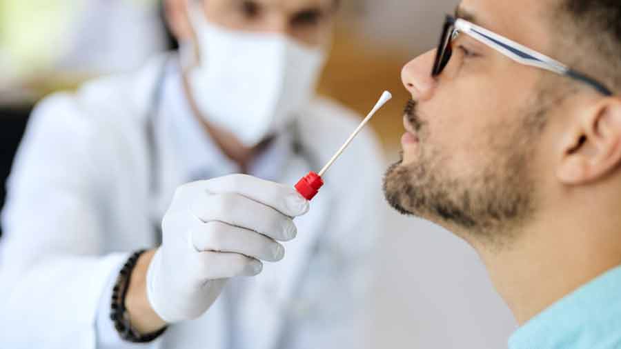 Las pruebas de antígenos no son indicador fiable ahora, mencionan los expertos