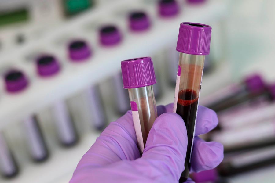 Las pruebas serológicas son de dos tipos y su objetivo es buscar anticuerpos en la sangre del paciente.