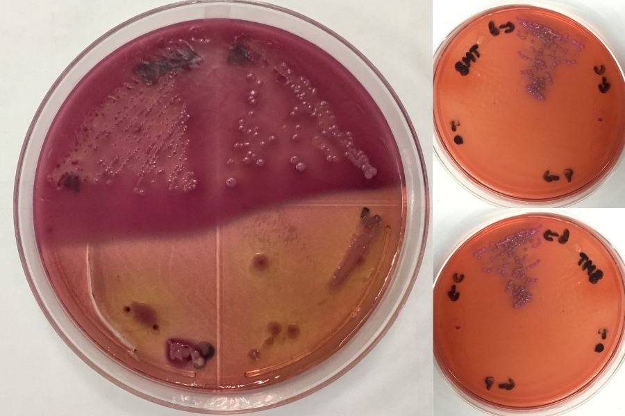 Avances de resultados de cultivo de bacteria "escherichia coli".