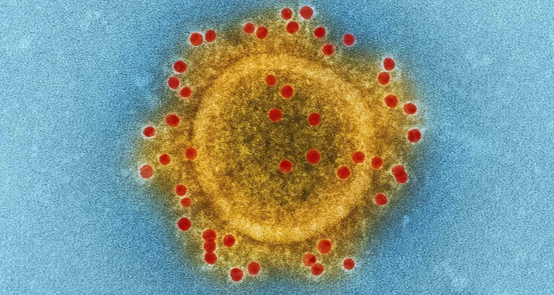 Coronavirus investigado por científicos del Tec de Monterrey