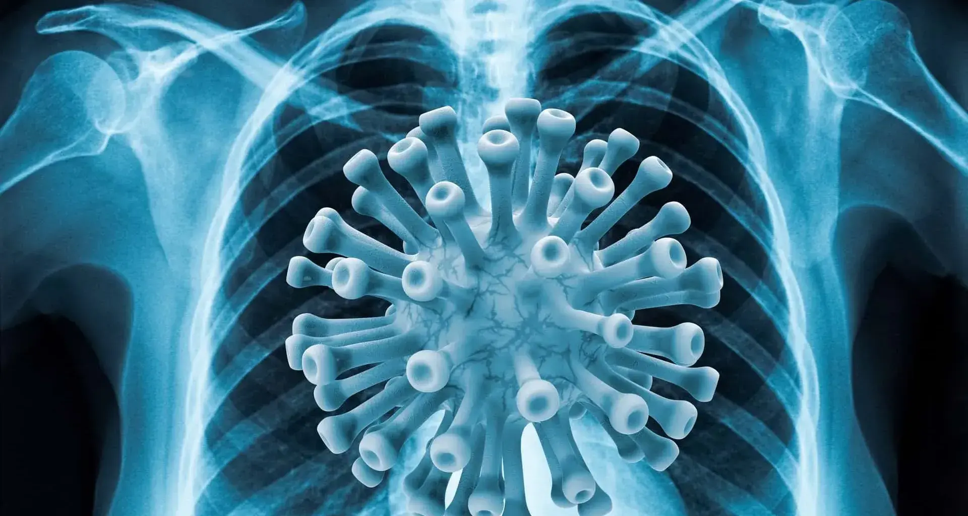 Tec engineers attemp to detect COVID-19 with artificial intellgence