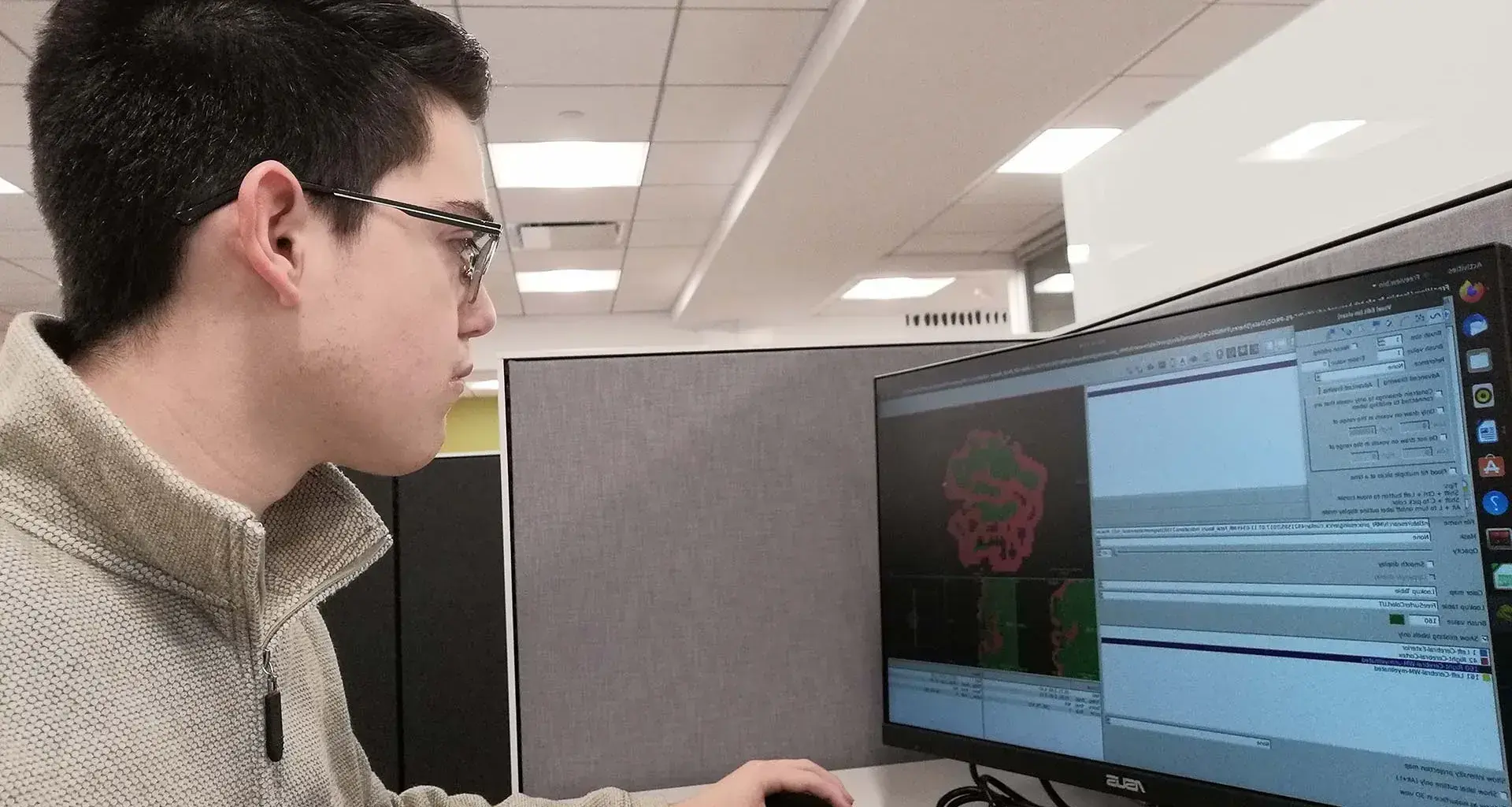 Mexican designs software to detect brain problems in babies