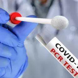 No es necesaria la prueba PCR si ya tuviste COVID