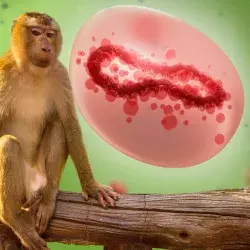 ¿Qué implica que la viruela del mono sea emergencia mundial?