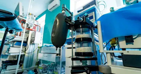 Los ventiladores o respiradores que son clave para enfermos COVID
