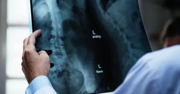 Mexicana EXATEC es premiada en Alemania por proyecto médico 2D